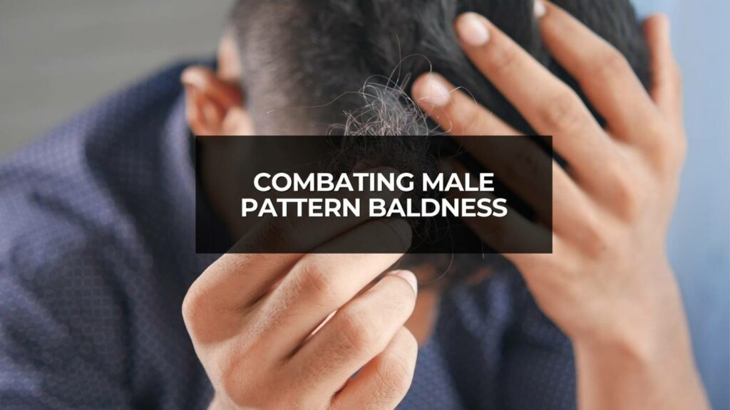 Combating Male Pattern Baldness: Effective Strategies and Emerging Therapies